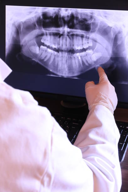 Best Teeth Whitening  in Ville Ptte, LA