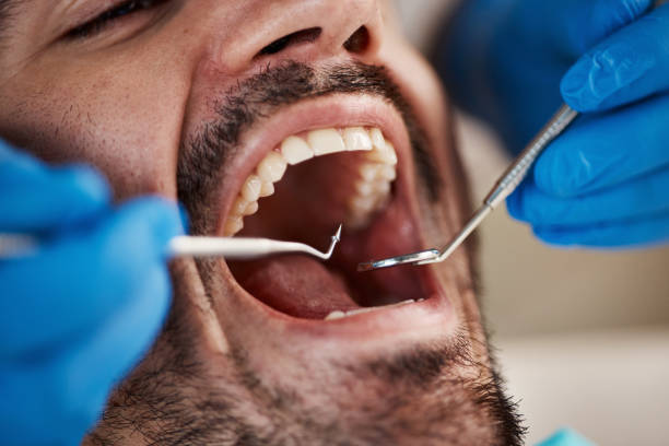 Best Affordable Emergency Dental Care  in Ville Ptte, LA