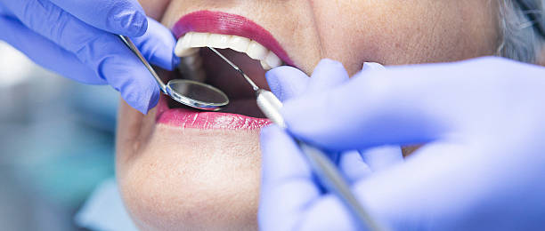 Best Chipped Tooth Repair Near Me  in Ville Ptte, LA