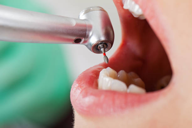 Best Dental Emergency Near Me  in Ville Ptte, LA